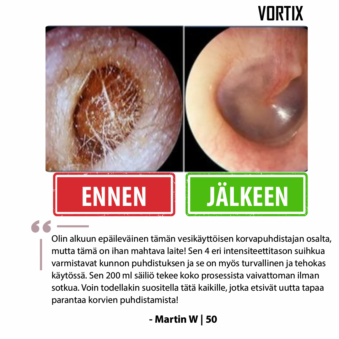 VORTIX sähkökäyttöinen laite korvavahan poistoon
