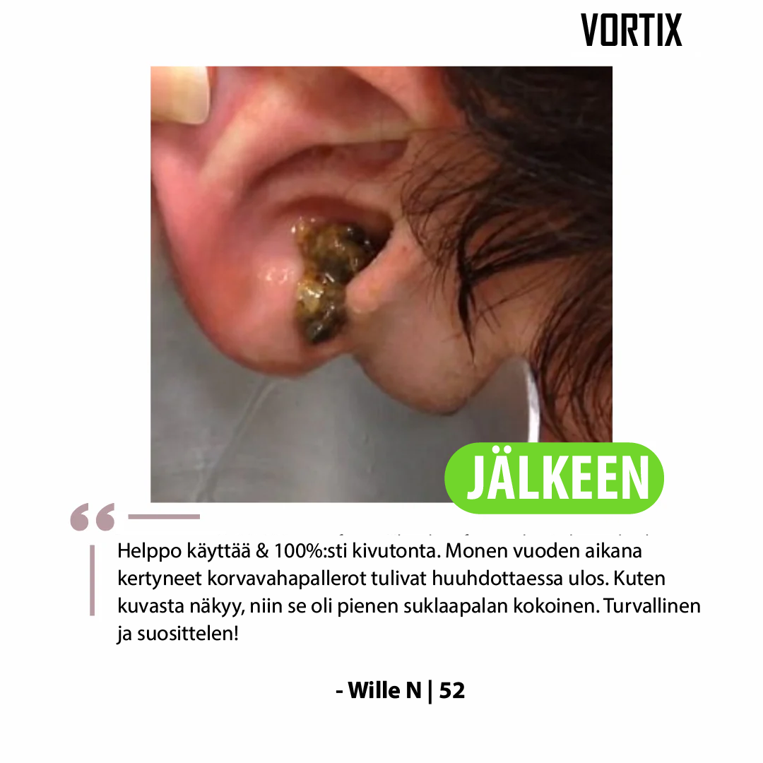 VORTIX sähkökäyttöinen laite korvavahan poistoon