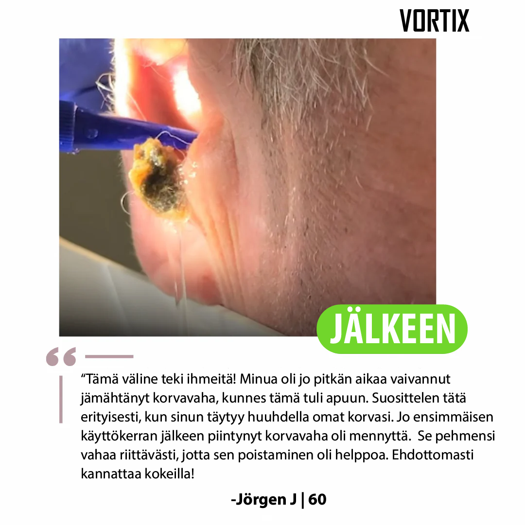 VORTIX sähkökäyttöinen laite korvavahan poistoon
