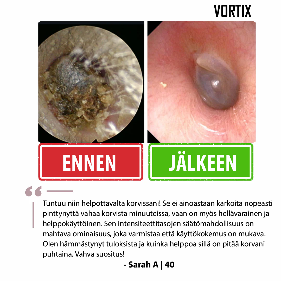 VORTIX sähkökäyttöinen laite korvavahan poistoon