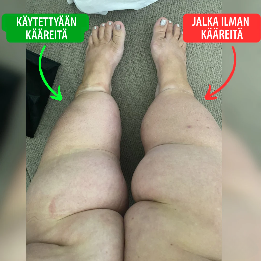Säärikompressiokääre